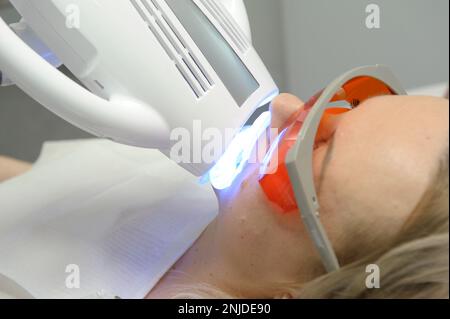Nahaufnahme des weiblichen Gesichts unter einem Apparat jenseits des Poluse Plus Advanced Whitening Systems mit Dental UV Laser Whitening Device in Brillengläsern zum Schutz gegen ultraviolette Zahnaufhellung Stockfoto