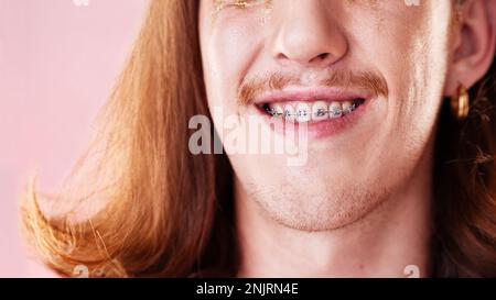 Gesicht, Zähne und Zahn beim Menschen in Zahnspangen, Kieferorthopädie und Schönheit mit Kosmetik und Gesundheitsversorgung auf rosa Hintergrund. Jung, Genz und Mode, mündlich Stockfoto