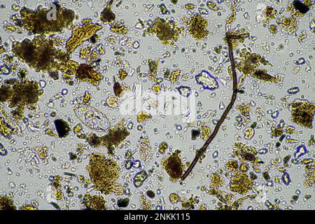 Bodenmikroorganismen in einer Bodenprobe, Bodenpilze und Bakterien in einem Regenerationsbetrieb im Kompost. Pilzhyphae im Bodenversuch. In australien Stockfoto