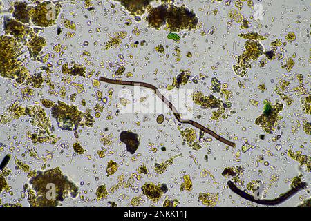 Bodenmikroorganismen in einer Bodenprobe, Bodenpilze und Bakterien in einem Regenerationsbetrieb im Kompost. Pilzhyphae im Bodenversuch. In australien Stockfoto
