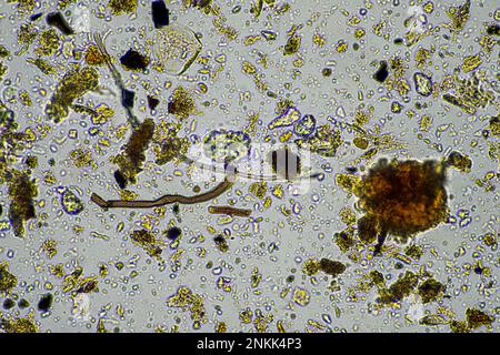 Bodenmikroorganismen in einer Bodenprobe, Bodenpilze und Bakterien in einem Regenerationsbetrieb im Kompost. Pilzhyphae im Bodenversuch. In australien Stockfoto