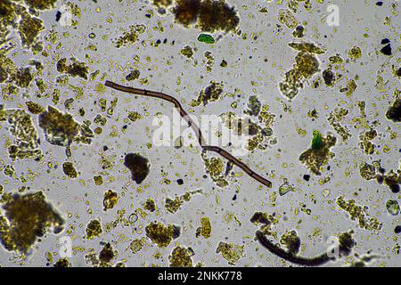 Bodenmikroorganismen in einer Bodenprobe, Bodenpilze und Bakterien in einem Regenerationsbetrieb im Kompost. Pilzhyphae im Bodenversuch. In australien Stockfoto