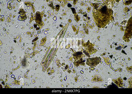 Bodenmikroorganismen in einer Bodenprobe, Bodenpilze und Bakterien in einem Regenerationsbetrieb im Kompost. Pilzhyphae im Bodenversuch. In australien Stockfoto