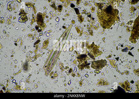 Bodenmikroorganismen in einer Bodenprobe, Bodenpilze und Bakterien in einem Regenerationsbetrieb im Kompost. Pilzhyphae im Bodenversuch. In australien Stockfoto