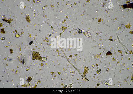 Bodenmikroorganismen in einer Bodenprobe, Bodenpilze und Bakterien in einem Regenerationsbetrieb im Kompost. Pilzhyphae im Bodenversuch. In australien Stockfoto