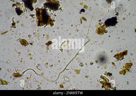 Bodenmikroorganismen in einer Bodenprobe, Bodenpilze und Bakterien in einem Regenerationsbetrieb im Kompost. Pilzhyphae im Bodenversuch. In australien Stockfoto