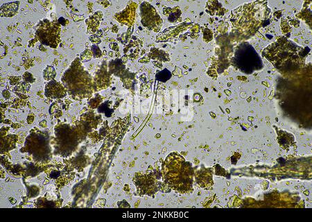 Bodenmikroorganismen in einer Bodenprobe, Bodenpilze und Bakterien in einem Regenerationsbetrieb im Kompost. Pilzhyphae im Bodenversuch. In australien Stockfoto