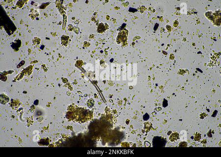 Bodenmikroorganismen in einer Bodenprobe, Bodenpilze und Bakterien in einem Regenerationsbetrieb im Kompost. Pilzhyphae im Bodenversuch. In australien Stockfoto
