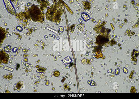 Bodenmikroorganismen in einer Bodenprobe, Bodenpilze und Bakterien in einem Regenerationsbetrieb im Kompost. Pilzhyphae im Bodenversuch. In australien Stockfoto