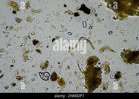 Bodenmikroorganismen in einer Bodenprobe, Bodenpilze und Bakterien in einem Regenerationsbetrieb im Kompost. Pilzhyphae im Bodenversuch. In australien Stockfoto