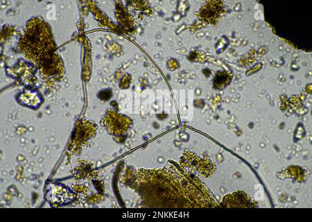 Bodenmikroorganismen in einer Bodenprobe, Bodenpilze und Bakterien in einem Regenerationsbetrieb im Kompost. Pilzhyphae im Bodenversuch. In australien Stockfoto