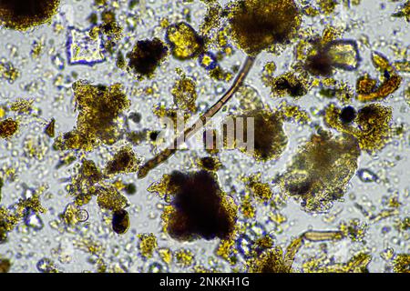 Bodenmikroorganismen in einer Bodenprobe, Bodenpilze und Bakterien in einem Regenerationsbetrieb im Kompost. Pilzhyphae im Bodenversuch. In australien Stockfoto