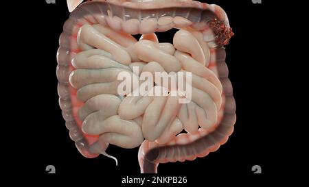 3D Darstellung der Anatomie des menschlichen Verdauungssystems, Darmerkrankungen, Abführmittel, Verstopfungsverhetzung, 3D Render Stockfoto