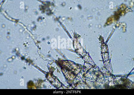Bodenmikroorganismen wie Nematoden, Mikroarthropoden, Mikroarthropoden, Tardigrade und Rotoren eine Bodenprobe, Bodenpilze und Bakterien auf einem Regen Stockfoto