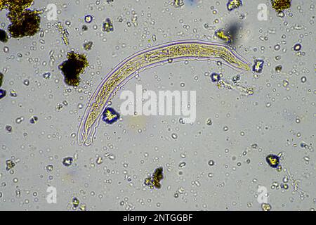 Bodenmikroorganismen wie Nematoden, Mikroarthropoden, Mikroarthropoden, Tardigrade und Rotoren eine Bodenprobe, Bodenpilze und Bakterien auf einem Regen Stockfoto