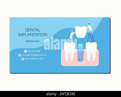 Vektorimplantatzahnärztliche Visitenkarten-Gestaltung. Zwei Implantologen setzen ein Zahnimplantat ein und eine Krone wird auf den Pfeiler gelegt. Neben gesunden Zähnen. Blaue und weiße Farben, flache Clips. Stock Vektor