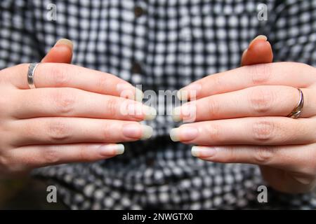 Weibliche Hände. Nahaufnahme-Frau zeigt ihre natürlichen Nägel ohne Nagellack. Lange Nägel weibliche Hände mit silbernen und goldenen Ringen. Stockfoto