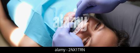 Frau mit zahnärztl. Gussfurnier am Oberkiefer in der Zahnmedizin Stockfoto