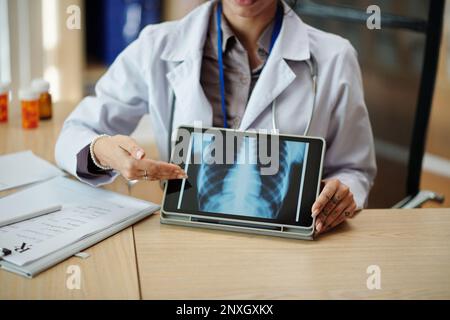 Hausarzt zeigt Tablet-Computer mit Röntgenbild von Ausfallschritten auf dem Bildschirm Stockfoto