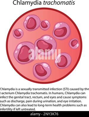 Chlamydia trachomatis mit erläuternder Darstellung Stock Vektor