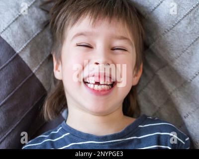 Lachendes Kind zeigt ein Loch in der Zahnreihe in seinem Mund. Gerade ist ein Schneidezahne herausgefallen. Nahaufnahme des Zahnfleisches für den Zahnarzt. Stockfoto