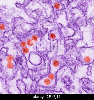 This 2016 digitally-colorized electron microscope image made available by the Centers for Disease Control and Prevention shows the Zika virus, in red, about 40 nanometers in diameter. In research published on Thursday, Aug. 4, 2016, three experimental vaccines protected monkeys against infection from the Zika virus, an encouraging sign as research moves into studies in people. (Cynthia Goldsmith/CDC via AP)