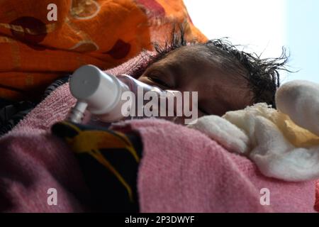 Kalkutta, Indien. 4. März 2023. Die Adenovirus-Infektion breitet sich in Kalkutta schnell aus. 4 Kinder sind in den letzten 24 Stunden gestorben. Säuglingstodesfälle durch Erkältungen und Lungeninfektionen, Lungenentzündung, Fieber usw. (Kreditbild: © Sayantan Chakraborty/Pacific Press via ZUMA Press Wire) NUR REDAKTIONELLE VERWENDUNG! Nicht für den kommerziellen GEBRAUCH! Stockfoto