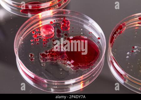 Schließen Sie Petrischalen des Labors mit Blutproben. Agar für biologisches Reserach. Stockfoto