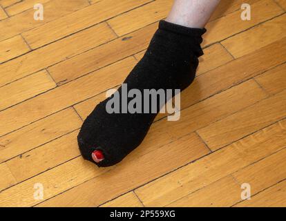 Weiblicher Fuß in gerissener Socke mit herausragendem großen Zeh Stockfoto