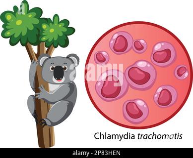 Chlamydia trachomatis mit erläuternder Darstellung Stock Vektor