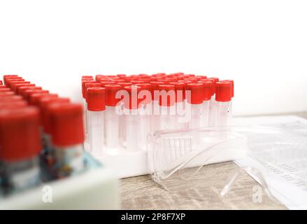 Ein leeres Blutprobenröhrchen mit roter Kappe auf dem Schreibtisch im Hämatologielabor, Hämatologie-Labor-Konzept Stockfoto
