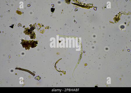 Bodenmikroorganismen wie Nematoden, Mikroarthropoden, Mikroarthropoden, Tardigrade und Rotoren eine Bodenprobe, Bodenpilze und Bakterien auf einem Regen Stockfoto