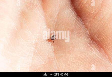 Ein Tier Zecken an einer menschlichen Hand Stockfoto