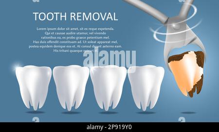 Zahnentfernungsvektor medizinische Poster Banner-Vorlage Stock Vektor