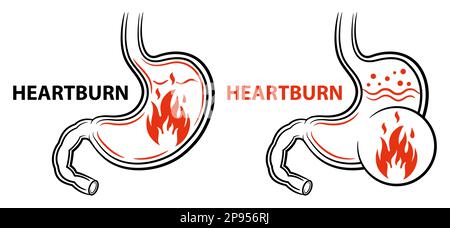 Sodbrennen, Magenbrennen Feuer Schmerzen, Gastritis, GERD saures Reflux Krankheit, Magengeschwür Symbol. Medikamentöse Behandlung des Verdauungssystems. Vektor Stock Vektor