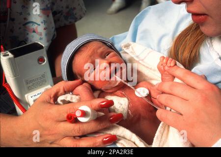 Frühgeborene mit Atemschlauch. Die Lungen müssen sich noch entwickeln. Neugeborenenstation eines New Yorker Krankenhauses. Stockfoto