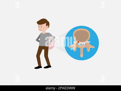 Junger Mann mit Rückenschmerzen und Darstellung eines lumbalen Bandscheibenvorfalls. Stock Vektor