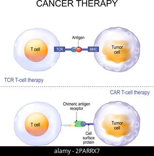 Krebsbehandlung. T-Zell-Therapie mit T-Zell-Rezeptor (TCR) oder chimärer Antigen-Rezeptor (CAR). Leukozyten- und Tumorzellen. Vektorposter Stock Vektor