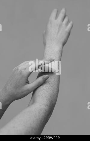 Sommersprossen an den Händen eines schönen Mädchens Stockfoto