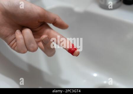 Nahaufnahme des blutigen Fingers einer Frau über der Spüle Stockfoto