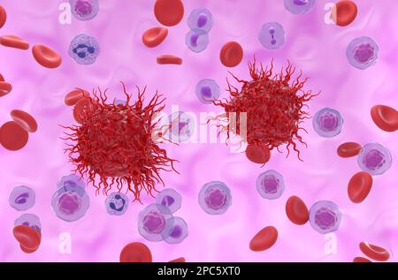 Metastatische neuroendokrine Tumorzellen im Blutfluss - 3D-Darstellung isometrischer Ansicht Stockfoto