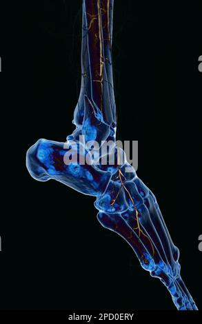 Angiogramm der A. femoralis oder Angiographie im Bereich der unteren Extremitäten. Stockfoto