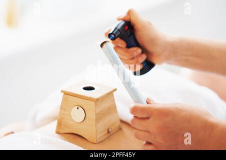 Das Bild der Moxibustionstherapie am weiblichen Körper Stockfoto