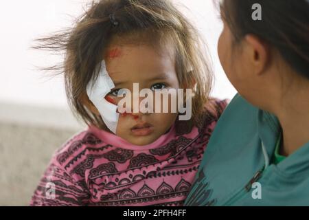 Ein junges Mädchen mit Schnitten, Schürfwunden und einem Verband im Gesicht, schaut nach einem Motorradunfall in die Kamera. In den Armen einer Frau. Stockfoto