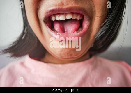 Nahaufnahme eines schreienden Kindes zu Hause Stockfoto