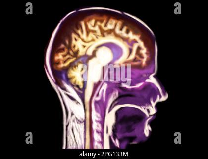 Scan des menschlichen Gehirnbereichs auf schwarzem Hintergrund, Illustration Stockfoto