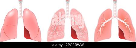 Lungenanatomie. Querschnitt des menschlichen Respirationstraktes mit Trachea, Kehlkopf und Bronchien. Aufbau des Respirationssystems. Realistischer Vektor Stock Vektor