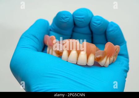 Die Hand eines Mannes in einem blauen Gummihandschuh hält einen Zahnersatz. Schließen. Stockfoto