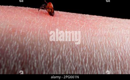 Häkchen (Acarina sp.) Erwachsene, Fütterung, auf menschlicher Haut mit Entzündung, England, Großbritannien Stockfoto