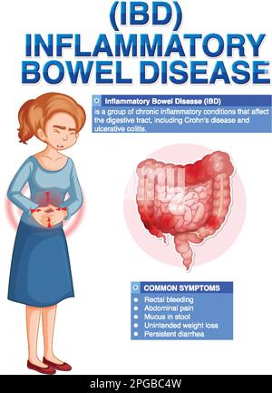 Chronisch entzündliche Darmerkrankungen (IBD) Infografik Illustration Stock Vektor